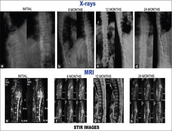 https://cdn.ncbi.nlm.nih.gov/pmc/blobs/b183/5414445/ece2b0c41a6a/AMHSR-6-311-g007.jpg