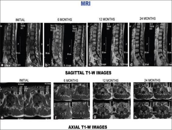 https://cdn.ncbi.nlm.nih.gov/pmc/blobs/b183/5414445/f6ac89e2f8d3/AMHSR-6-311-g014.jpg