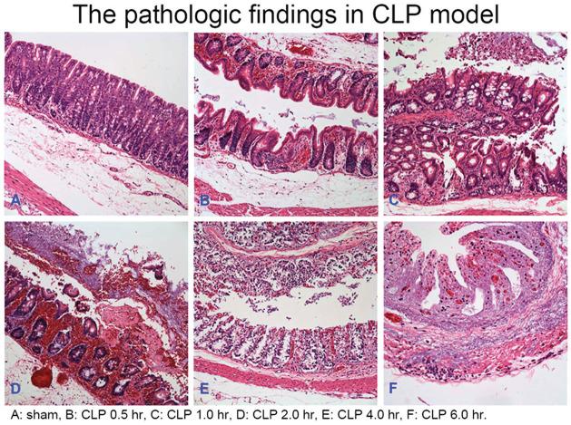https://cdn.ncbi.nlm.nih.gov/pmc/blobs/b186/9127845/ef8c5780f79b/10.1177_03946320221090021-fig2.jpg