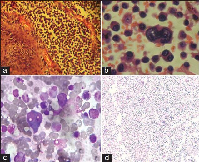 https://cdn.ncbi.nlm.nih.gov/pmc/blobs/b18b/3858766/9375825ed85f/JNRP-4-445-g004.jpg