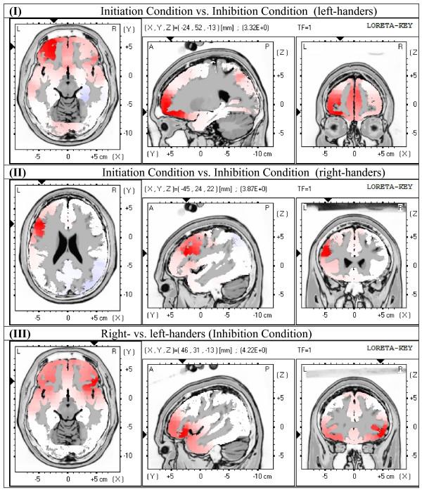 https://cdn.ncbi.nlm.nih.gov/pmc/blobs/b18d/2806301/aad8205e0b6b/1744-9081-5-51-2.jpg