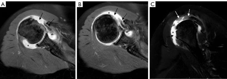 https://cdn.ncbi.nlm.nih.gov/pmc/blobs/b191/10721994/62fe148d0db7/qims-13-12-8274-f4.jpg