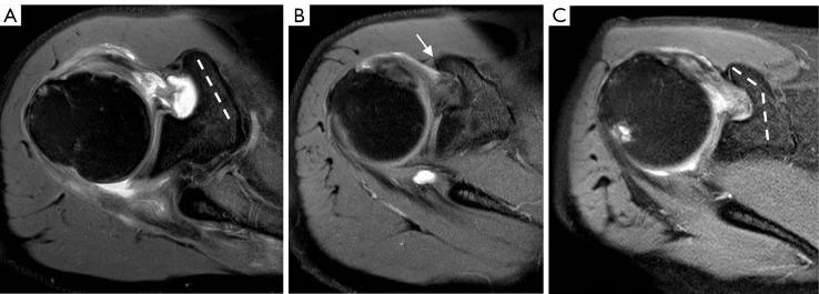 https://cdn.ncbi.nlm.nih.gov/pmc/blobs/b191/10721994/85fbd0c5c227/qims-13-12-8274-f5.jpg