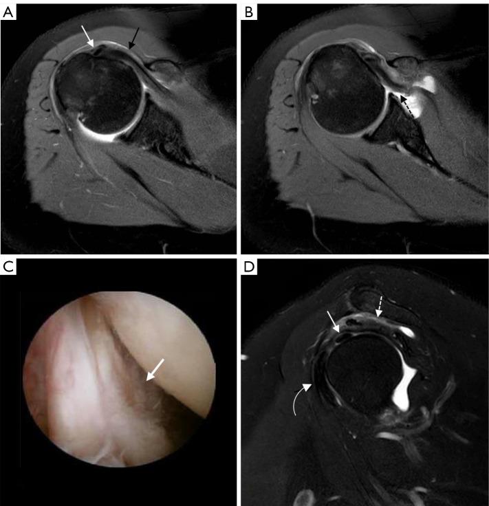 https://cdn.ncbi.nlm.nih.gov/pmc/blobs/b191/10721994/ff5f47235255/qims-13-12-8274-f3.jpg