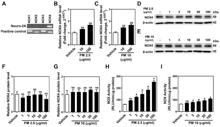 https://cdn.ncbi.nlm.nih.gov/pmc/blobs/b197/11172693/72c2dc30b5f1/ijms-25-06116-g002.jpg