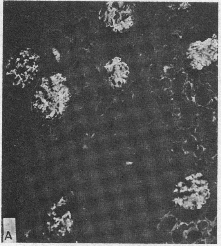 https://cdn.ncbi.nlm.nih.gov/pmc/blobs/b197/292650/6eb676272aad/jcinvest00258-0088-a.jpg