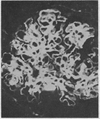 https://cdn.ncbi.nlm.nih.gov/pmc/blobs/b197/292650/7f0b26a370a1/jcinvest00258-0089-b.jpg