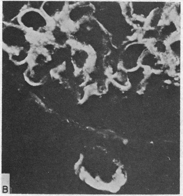 https://cdn.ncbi.nlm.nih.gov/pmc/blobs/b197/292650/a0b54ed76e01/jcinvest00258-0088-c.jpg