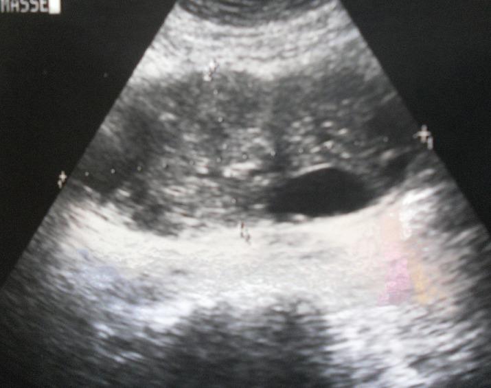https://cdn.ncbi.nlm.nih.gov/pmc/blobs/b1a9/3527067/28ef9f0e9ac4/PAMJ-13-17-g001.jpg