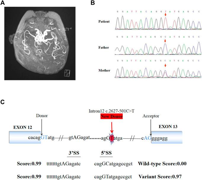 https://cdn.ncbi.nlm.nih.gov/pmc/blobs/b1ba/9008829/7e5fa8784abc/fgene-13-852764-g001.jpg