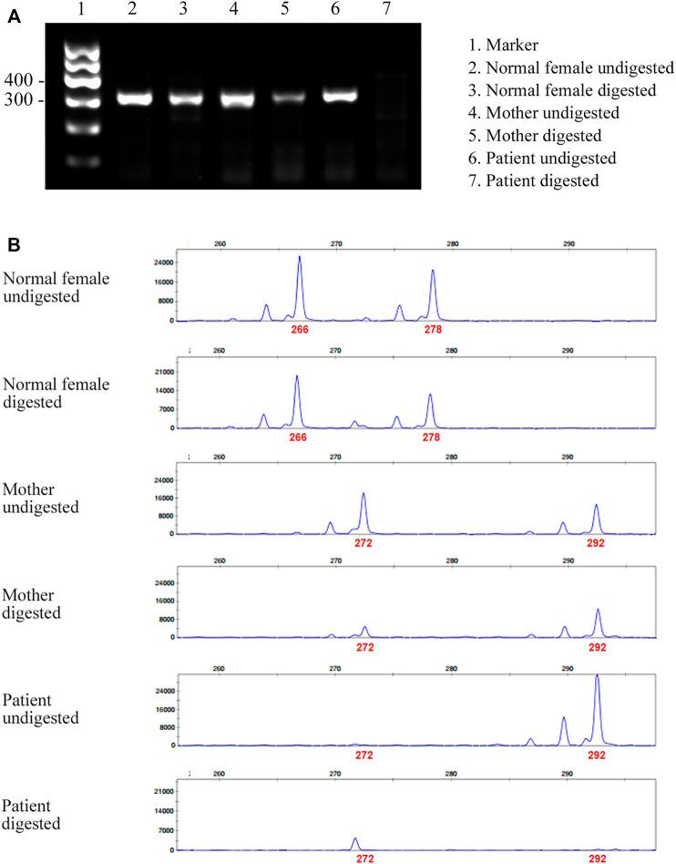https://cdn.ncbi.nlm.nih.gov/pmc/blobs/b1ba/9008829/b3437e37af3d/fgene-13-852764-g003.jpg