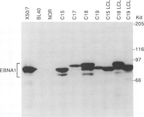 https://cdn.ncbi.nlm.nih.gov/pmc/blobs/b1bb/241023/36376ae8986b/jvirol00037-0103-a.jpg