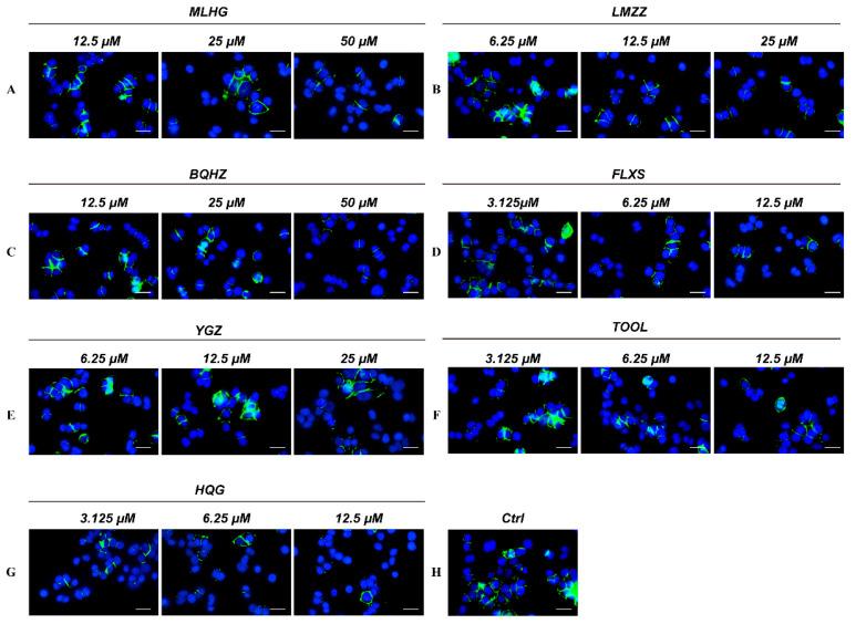 https://cdn.ncbi.nlm.nih.gov/pmc/blobs/b1bd/12029895/c80372ed67c7/molecules-30-01754-g005.jpg