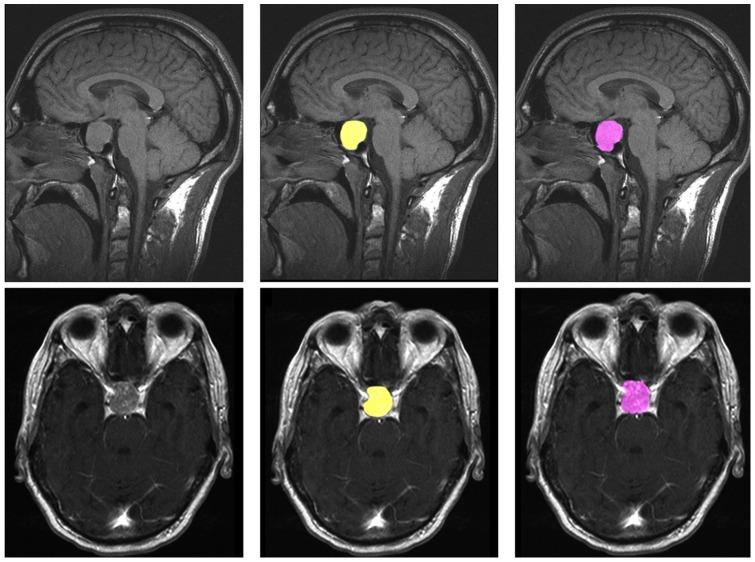 https://cdn.ncbi.nlm.nih.gov/pmc/blobs/b1be/3519899/291919ac1a47/pone.0051788.g004.jpg
