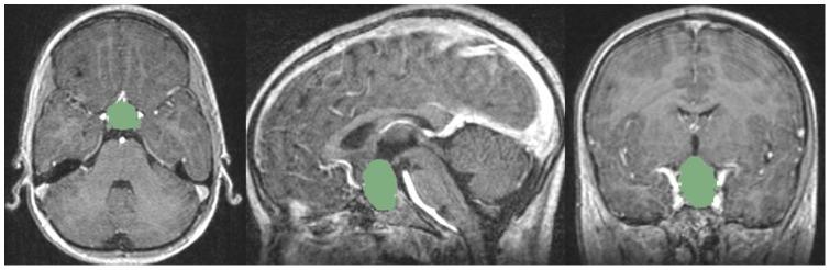 https://cdn.ncbi.nlm.nih.gov/pmc/blobs/b1be/3519899/463d3dae742a/pone.0051788.g003.jpg