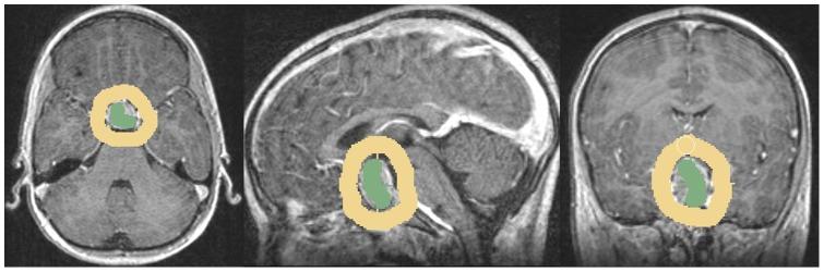 https://cdn.ncbi.nlm.nih.gov/pmc/blobs/b1be/3519899/51828bcc0a95/pone.0051788.g002.jpg