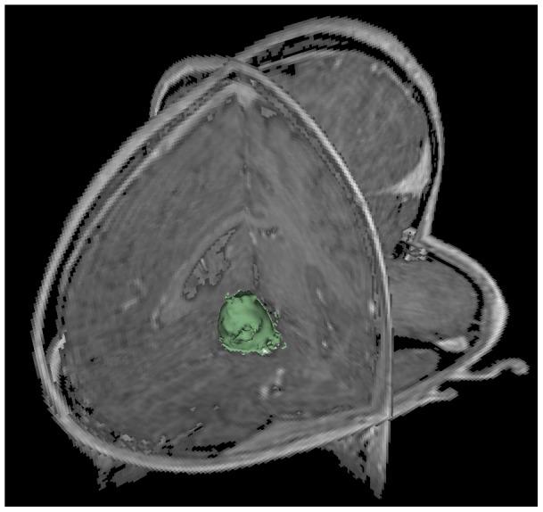 https://cdn.ncbi.nlm.nih.gov/pmc/blobs/b1be/3519899/d25b83581759/pone.0051788.g005.jpg