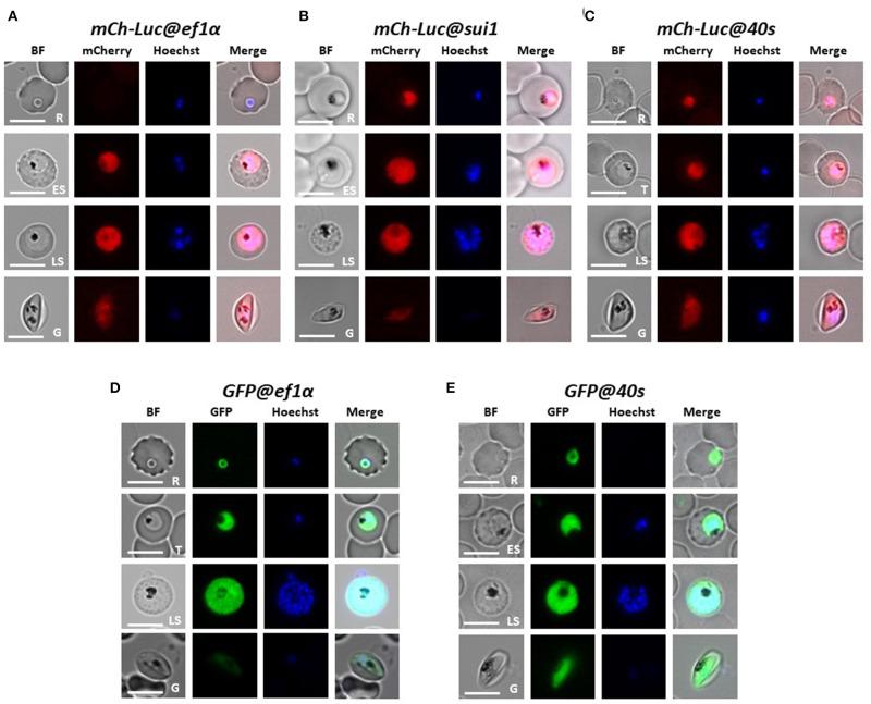 https://cdn.ncbi.nlm.nih.gov/pmc/blobs/b1ce/7298075/eeed60b2a547/fcimb-10-00270-g0002.jpg