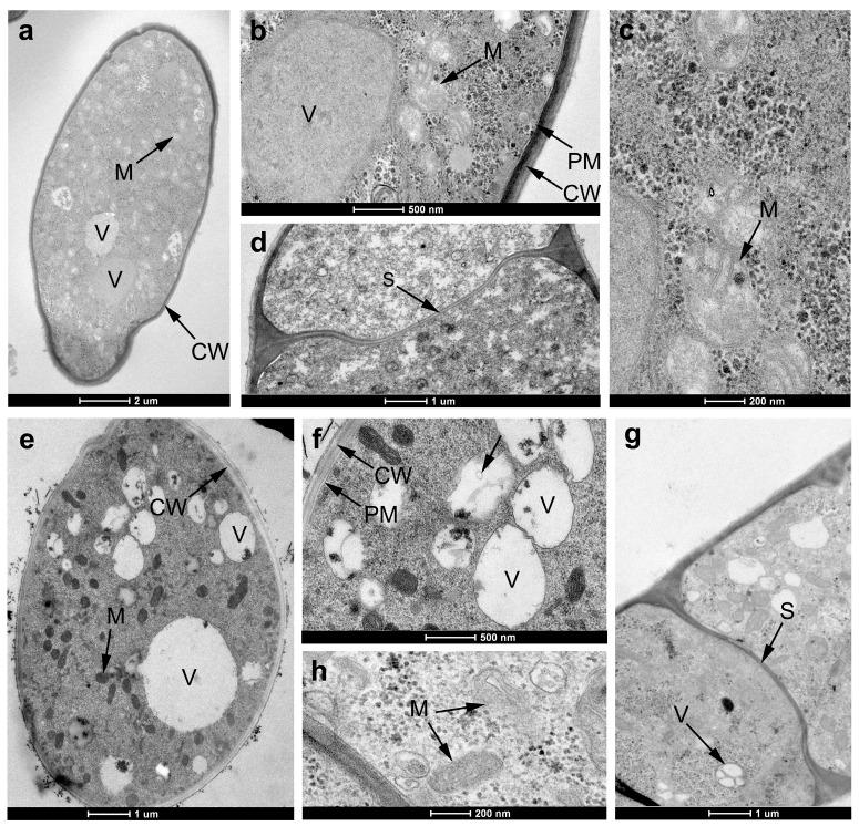 https://cdn.ncbi.nlm.nih.gov/pmc/blobs/b1cf/6320924/9059d77411a6/ijms-19-04044-g006.jpg