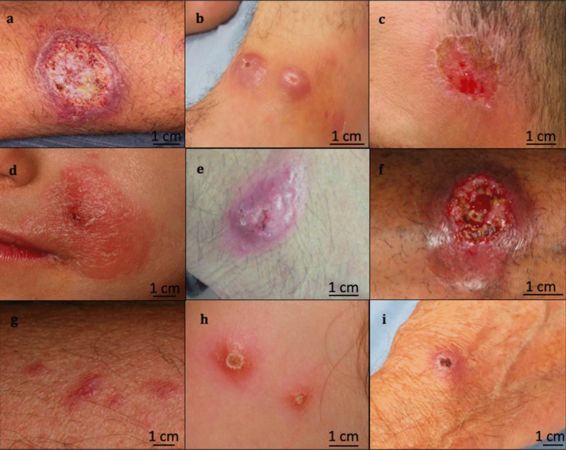 https://cdn.ncbi.nlm.nih.gov/pmc/blobs/b1d8/8442464/ee1b1a2b6e10/12879_2021_6631_Fig1_HTML.jpg