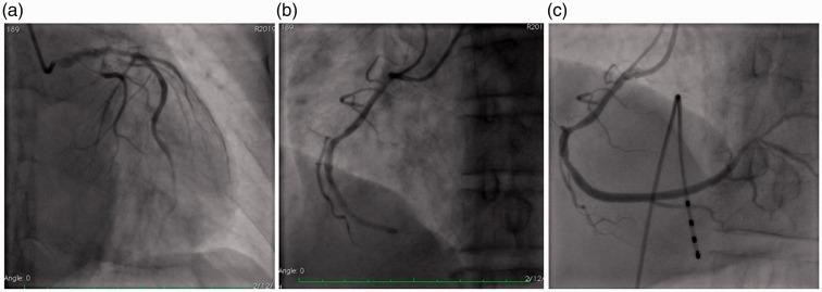 https://cdn.ncbi.nlm.nih.gov/pmc/blobs/b1db/6753530/03d44924edce/10.1177_0300060519865626-fig3.jpg
