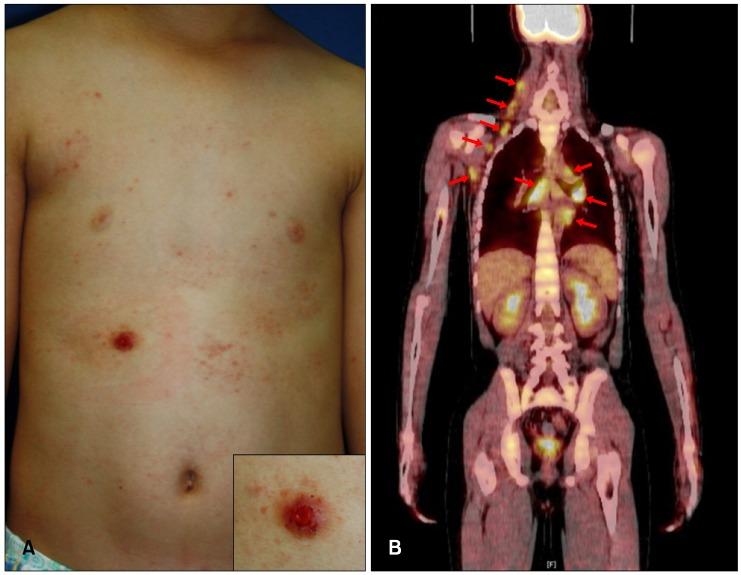 https://cdn.ncbi.nlm.nih.gov/pmc/blobs/b1dd/4884715/b8177efb077c/ad-28-371-g001.jpg