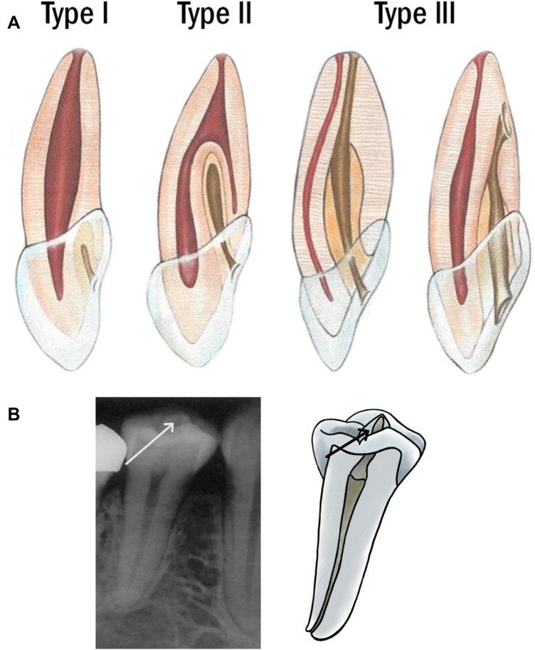 https://cdn.ncbi.nlm.nih.gov/pmc/blobs/b1de/8273054/2738105c3755/223_2021_835_Fig1_HTML.jpg