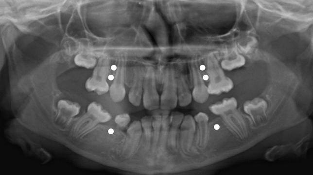 https://cdn.ncbi.nlm.nih.gov/pmc/blobs/b1de/8273054/56a7f77fa47a/223_2021_835_Fig2_HTML.jpg