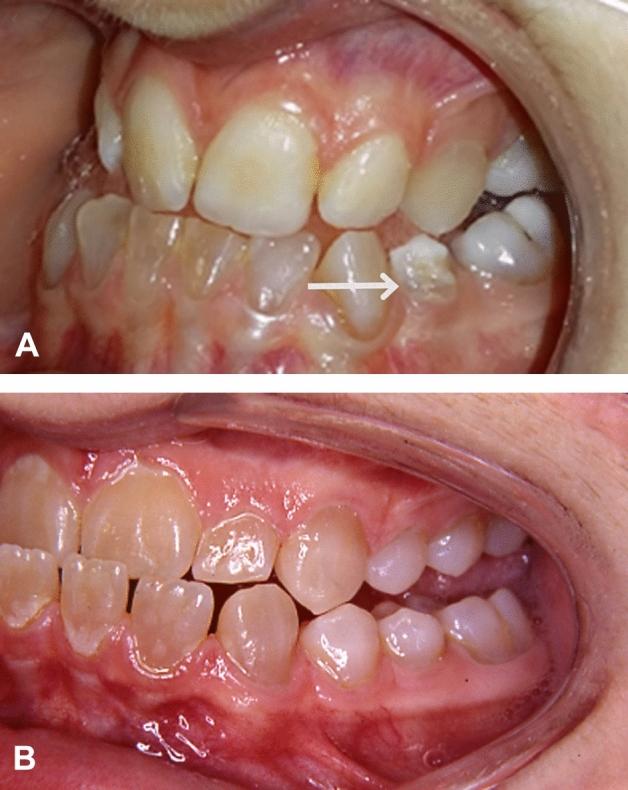 https://cdn.ncbi.nlm.nih.gov/pmc/blobs/b1de/8273054/5800d2a92a20/223_2021_835_Fig4_HTML.jpg