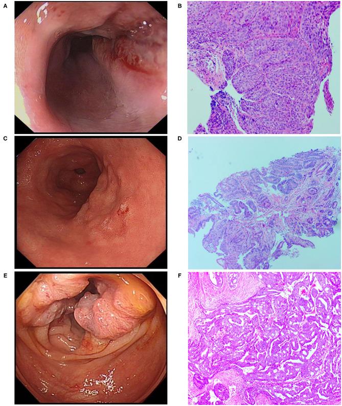 https://cdn.ncbi.nlm.nih.gov/pmc/blobs/b1e5/8299121/600b92ba0eb0/fgene-12-676497-g0001.jpg