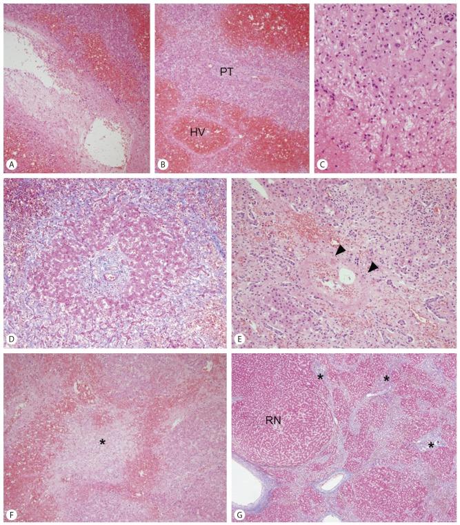 https://cdn.ncbi.nlm.nih.gov/pmc/blobs/b1ea/4379203/4a00221b6f21/cmh-21-89-g002.jpg