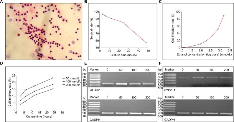 https://cdn.ncbi.nlm.nih.gov/pmc/blobs/b1ea/5942392/4d5ca79a0157/cmar-10-1037Fig1.jpg