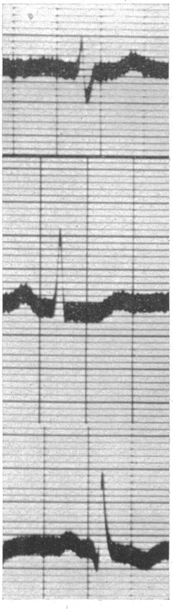 https://cdn.ncbi.nlm.nih.gov/pmc/blobs/b1ed/479433/b28e75331c71/brheartj00405-0117-a.jpg