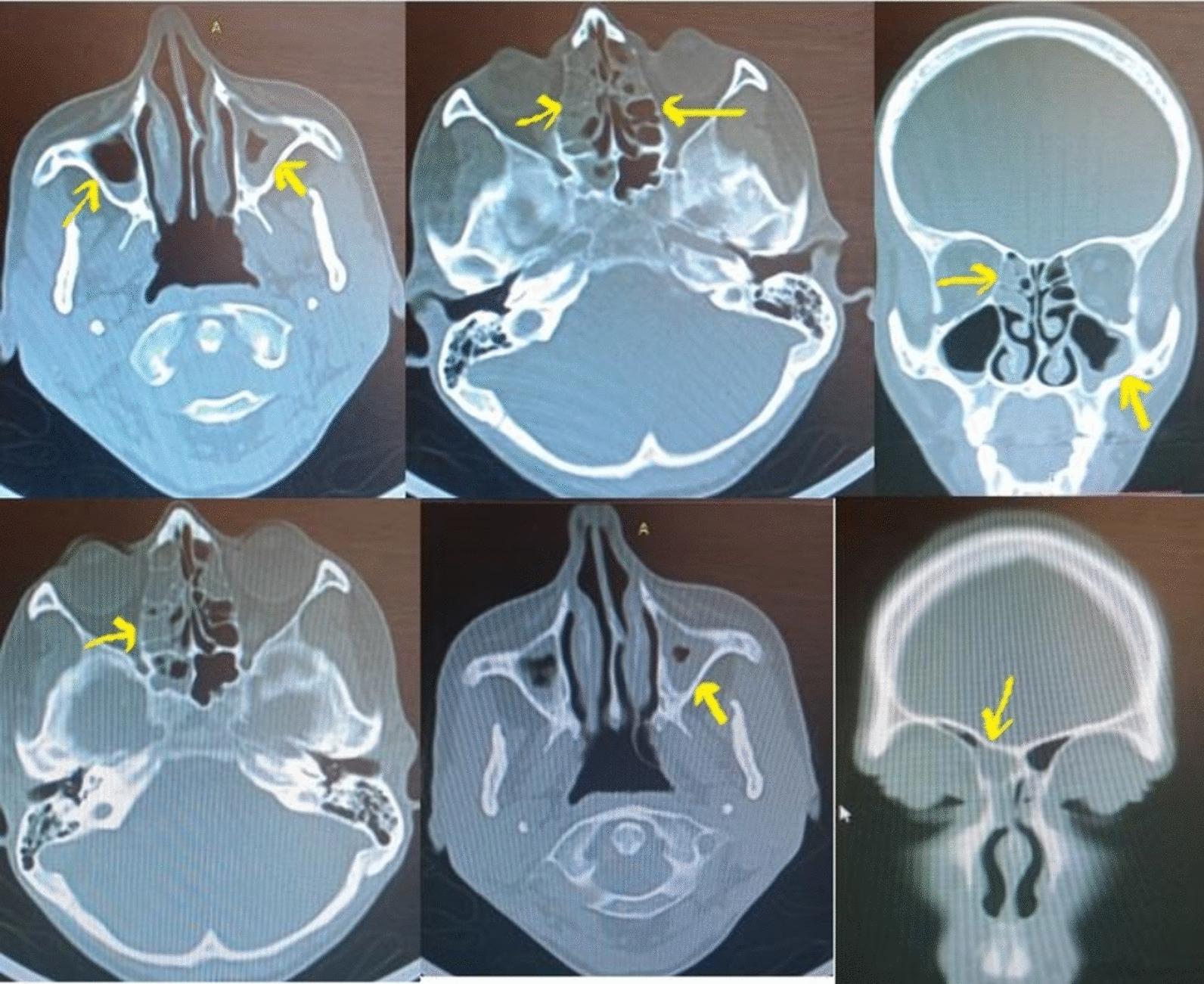 https://cdn.ncbi.nlm.nih.gov/pmc/blobs/b1f2/11334302/dfc7a7231298/13256_2024_4696_Fig2_HTML.jpg