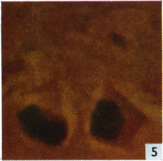 https://cdn.ncbi.nlm.nih.gov/pmc/blobs/b1f4/1244459/198dfa001114/janat00435-0009-e.jpg