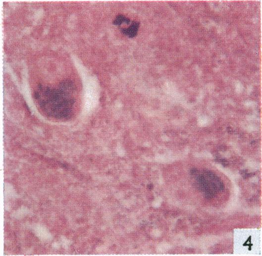 https://cdn.ncbi.nlm.nih.gov/pmc/blobs/b1f4/1244459/35ca80109633/janat00435-0009-d.jpg