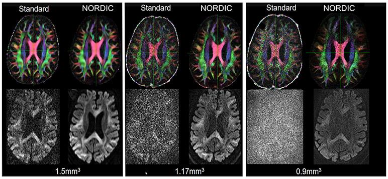 https://cdn.ncbi.nlm.nih.gov/pmc/blobs/b1f5/7881933/11f59a82b26d/nihms-1666840-f0005.jpg