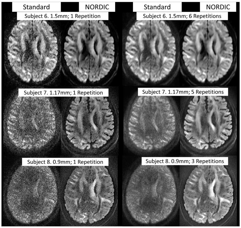 https://cdn.ncbi.nlm.nih.gov/pmc/blobs/b1f5/7881933/59ecb187ac5f/nihms-1666840-f0006.jpg