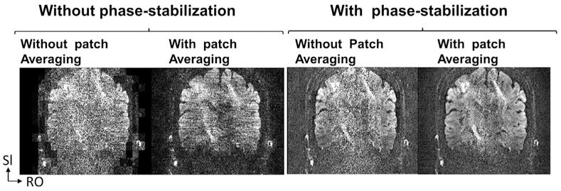 https://cdn.ncbi.nlm.nih.gov/pmc/blobs/b1f5/7881933/8f3cea052736/nihms-1666840-f0004.jpg