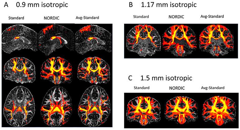 https://cdn.ncbi.nlm.nih.gov/pmc/blobs/b1f5/7881933/ae443e07d95f/nihms-1666840-f0010.jpg