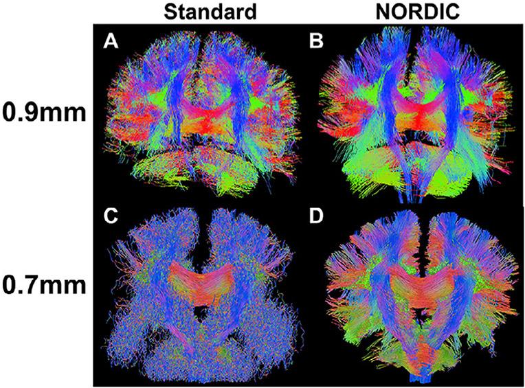 https://cdn.ncbi.nlm.nih.gov/pmc/blobs/b1f5/7881933/cd9af7581552/nihms-1666840-f0011.jpg