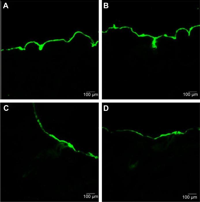 https://cdn.ncbi.nlm.nih.gov/pmc/blobs/b1f6/4516257/e0b7af969e2c/ijn-10-4639Fig6.jpg