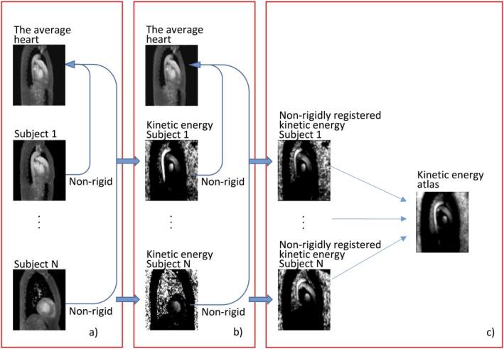 https://cdn.ncbi.nlm.nih.gov/pmc/blobs/b1f7/5655727/4f781990df62/JMRI-46-1389-g002.jpg
