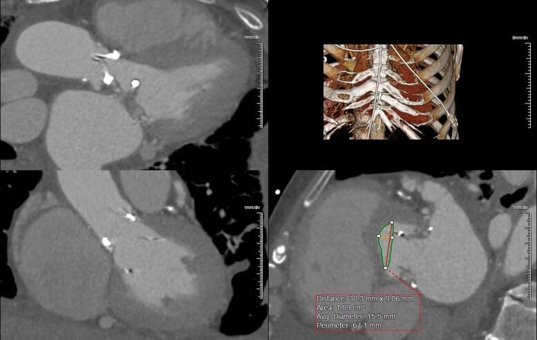 https://cdn.ncbi.nlm.nih.gov/pmc/blobs/b1fa/9585901/0dfd0dc976ab/ytac384f2.jpg