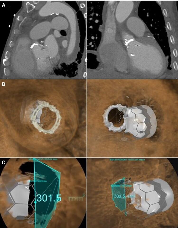 https://cdn.ncbi.nlm.nih.gov/pmc/blobs/b1fa/9585901/2cf957c1147c/ytac384f3.jpg