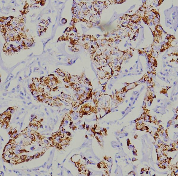 https://cdn.ncbi.nlm.nih.gov/pmc/blobs/b1fc/3852884/d17371d6ea28/1756-9966-32-77-2.jpg