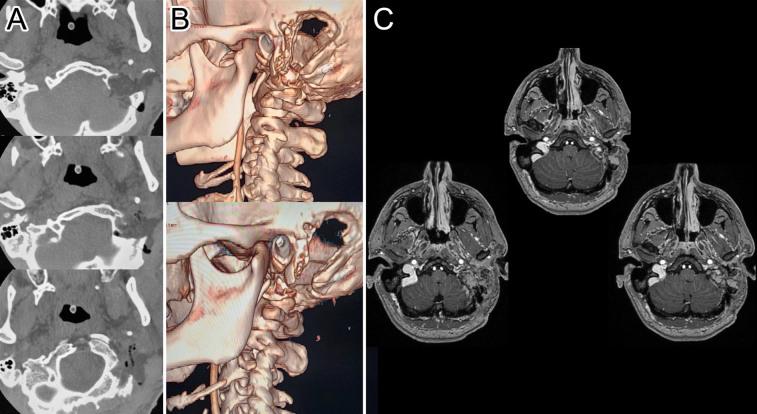 https://cdn.ncbi.nlm.nih.gov/pmc/blobs/b206/11488373/fc27a45f7886/CASE24396_figure_3.jpg