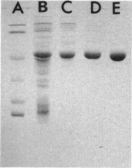 https://cdn.ncbi.nlm.nih.gov/pmc/blobs/b207/46174/120d239dd17d/pnas01466-0208-a.jpg