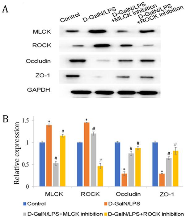 https://cdn.ncbi.nlm.nih.gov/pmc/blobs/b20a/8008219/31b6469b33ea/mmr-23-05-12031-g04.jpg