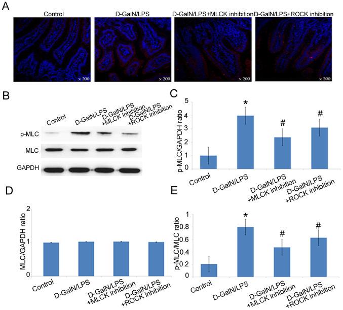 https://cdn.ncbi.nlm.nih.gov/pmc/blobs/b20a/8008219/b24b96476cba/mmr-23-05-12031-g03.jpg
